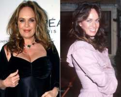 Catherine Bach before surgery